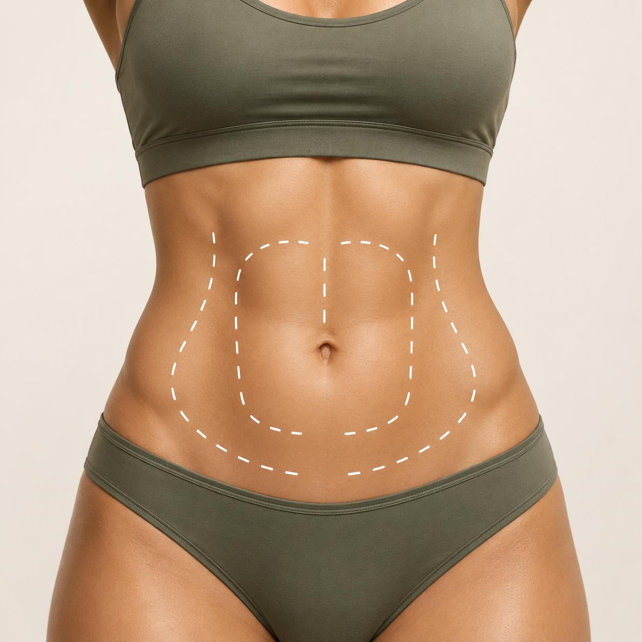 EMShape abdomen treatment area